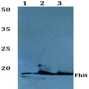 FHIT (E116) pAb avatar