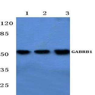 GABAA R(beta)1 (R328) pAb