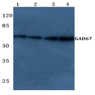 GAD-67 (A492) pAb avatar