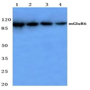 mGluR-6 (A865) pAb avatar