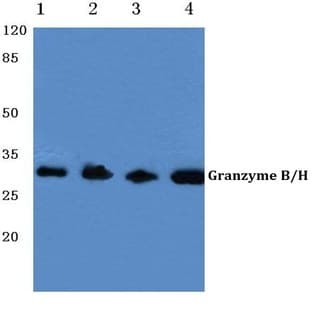 Granzyme B/H (E20) pAb avatar