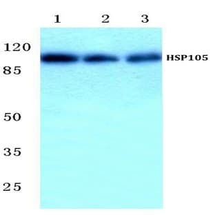 HSP105 (P819) pAb avatar