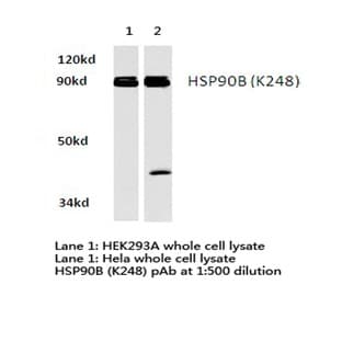 HSP90B (K248) pAb avatar