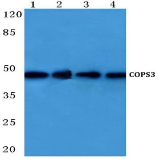 COPS3 (M408) pAb avatar