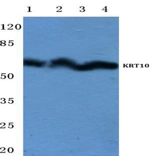 Cytokeratin 10 (Y160) pAb avatar