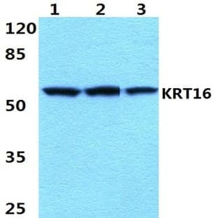 Cytokeratin 16 (S451) pAb avatar