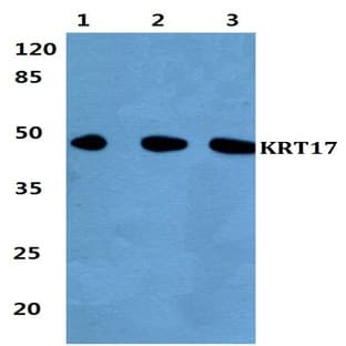 Cytokeratin 17 (V412) pAb avatar