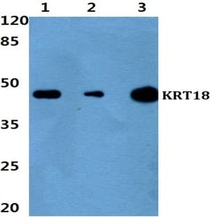 Cytokeratin 18 (P27) pAb avatar