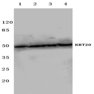 Cytokeratin 20 (D409) pAb avatar