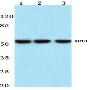 Cytokeratin 8 (V67) pAb avatar