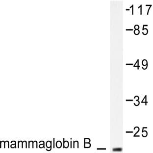 Mammaglobin B (K23) pAb avatar