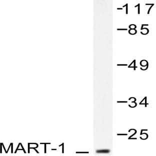 Melan-A (P75) pAb avatar