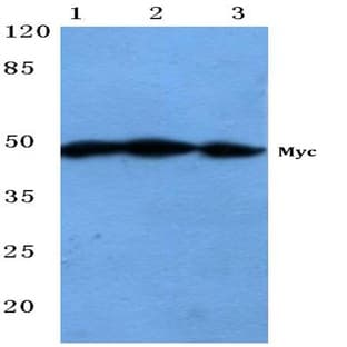 Myc (R367) pAb avatar