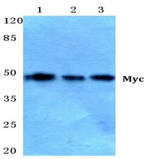 Myc (L56) pAb avatar
