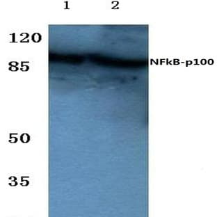 NFkB-p100 (S865) pAb