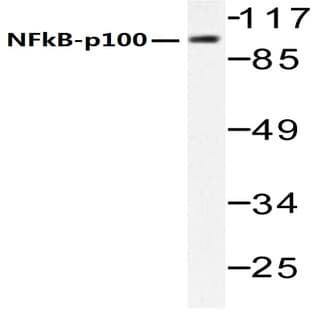 NFkB-p100 (S869) pAb