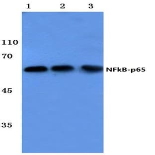 NFkB-p65 (L523) pAb avatar