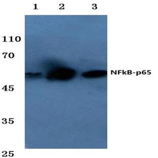 NFkB-p65 (G530) pAb avatar