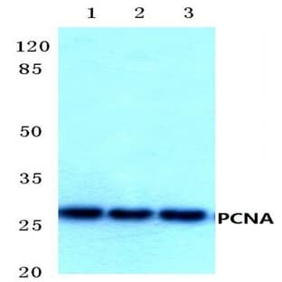 PCNA (I88) pAb avatar