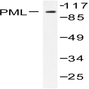 PML (P39) pAb avatar