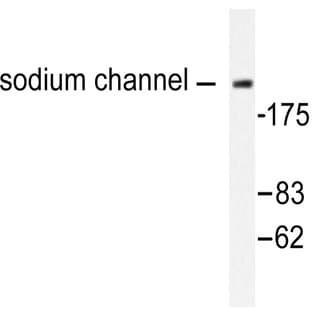 Na+ CP-pan (K1493) pAb avatar