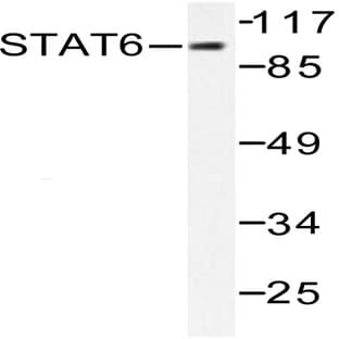 Stat6 (G635) pAb avatar
