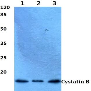 Cystatin B (N84) pAb avatar