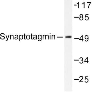 Synaptotagmin (M303) pAb avatar
