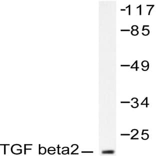 TGF(beta)2 (L388) pAb avatar
