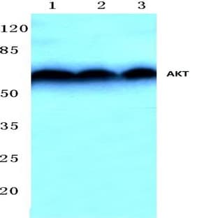 AKT (D302) pAb avatar