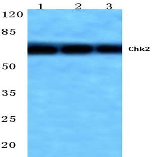 Chk2 (M381) pAb avatar