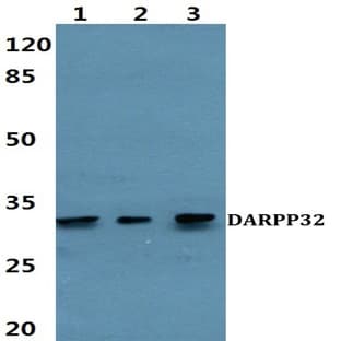 DARPP-32 (P69) pAb