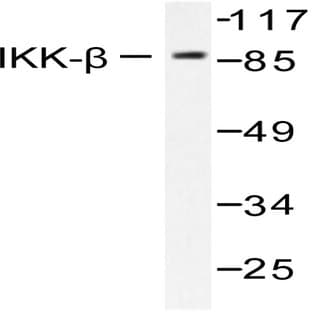 IKK(beta) (F182) pAb avatar