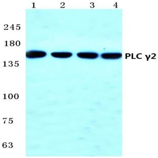 PLC (gamma)2 (R747) pAb avatar