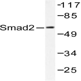 Smad2 (P459) pAb avatar