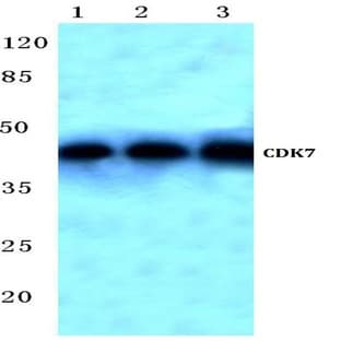 CDK7 (L325) pAb avatar