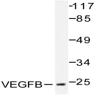 VEGFB (R125) pAb avatar