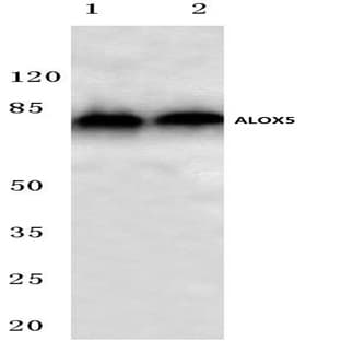 ALOX5 (E267) pAb avatar