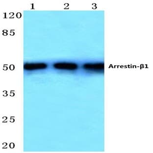Arrestin-(beta)-1 (E406) pAb avatar