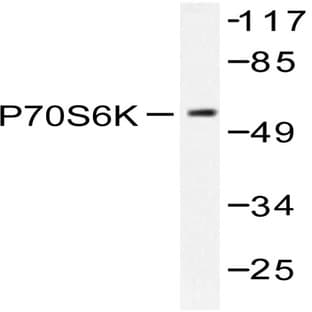 p70 S6K (D223) pAb