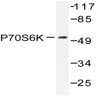 p70 S6K (R365) pAb