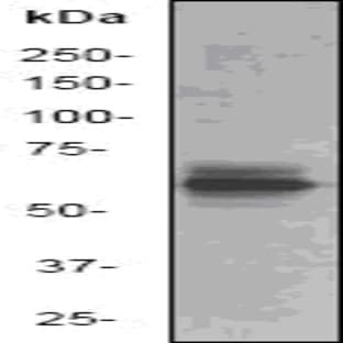 PAK1 (I206) pAb avatar