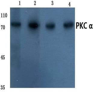 PKC (alpha) (G633) pAb avatar