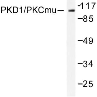 PKD1 (L905) pAb avatar