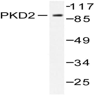 PKD2 (A872) pAb avatar