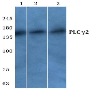 PLC (gamma)2 (N1211) pAb avatar