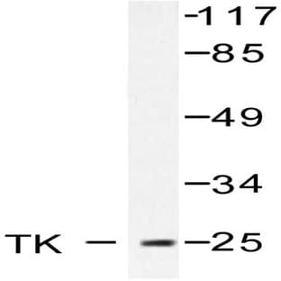 TK (P7) pAb