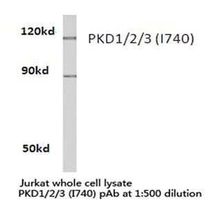 PKD1/2/3 (I740) pAb avatar