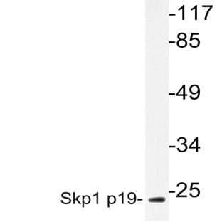 Skp1 p19 (P72) pAb avatar