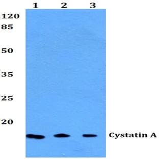 Cystatin A (G84) pAb avatar